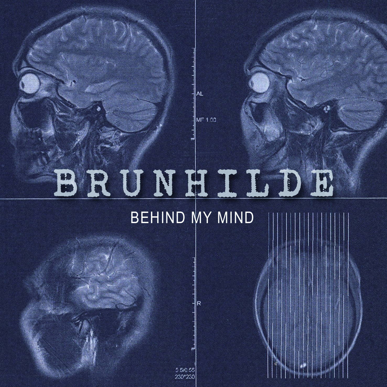 Brunhilde (De) – Behind My Mind